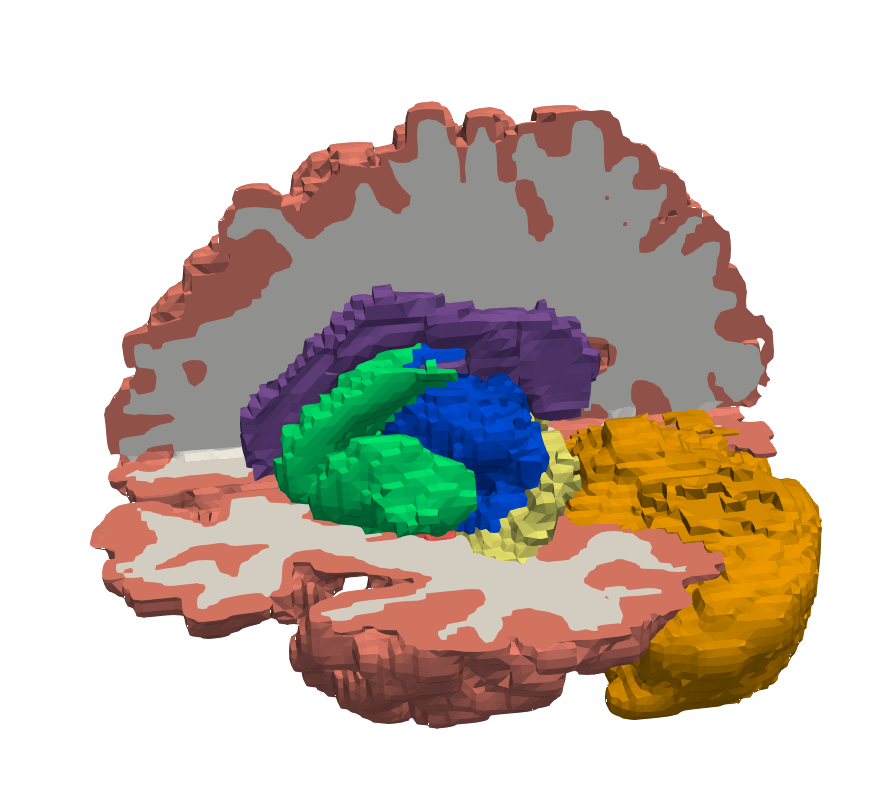 3D brain model